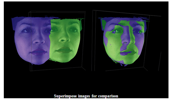 Facial Scanning – DIGITAL DENTOFACIAL CONCEPTS