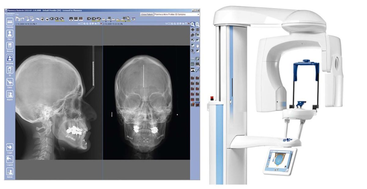 LATERAL CEPHALOGRAM – DIGITAL DENTOFACIAL CONCEPTS