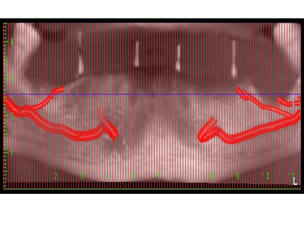 Gallery – DIGITAL DENTOFACIAL CONCEPTS