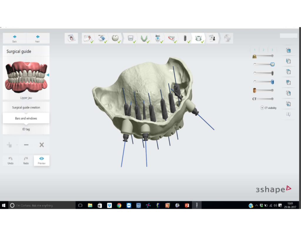 Gallery – DIGITAL DENTOFACIAL CONCEPTS