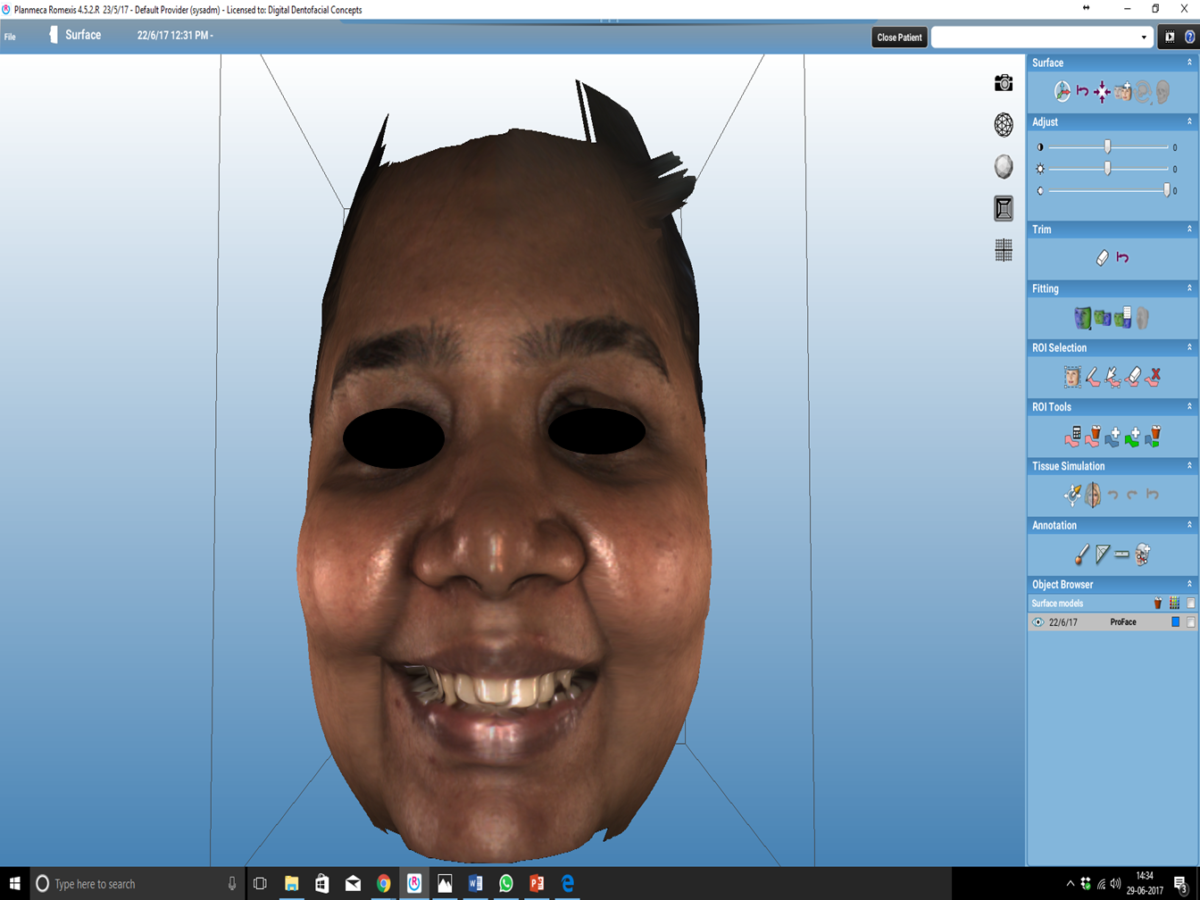 Gallery – DIGITAL DENTOFACIAL CONCEPTS