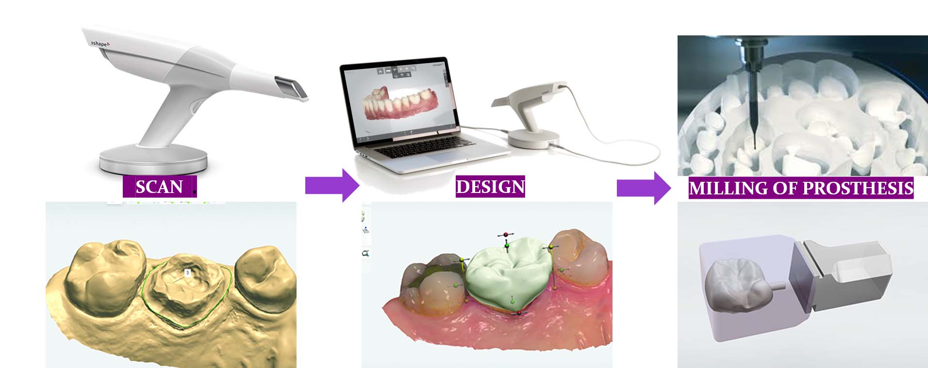 PROSTHETIC PLANNING – DIGITAL DENTOFACIAL CONCEPTS